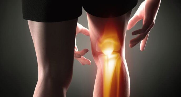 Symptômes d'arthrose