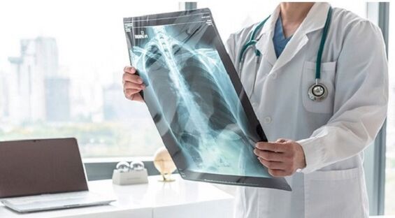Diagnostic aux rayons X de la douleur sous l'omoplate gauche